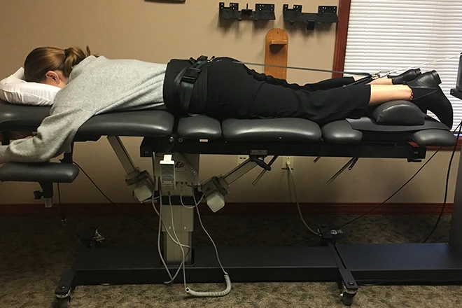 Woman on a chiropractic table undergoing spinal decompression therapy, lying prone.