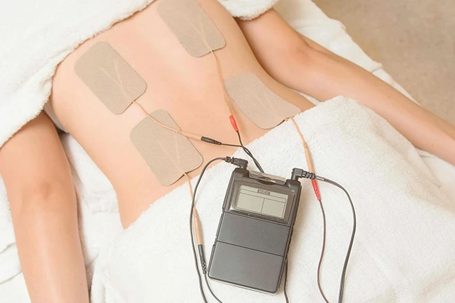 Woman receiving TENS unit treatment for back pain. Electrodes attached to lower back for pain management.