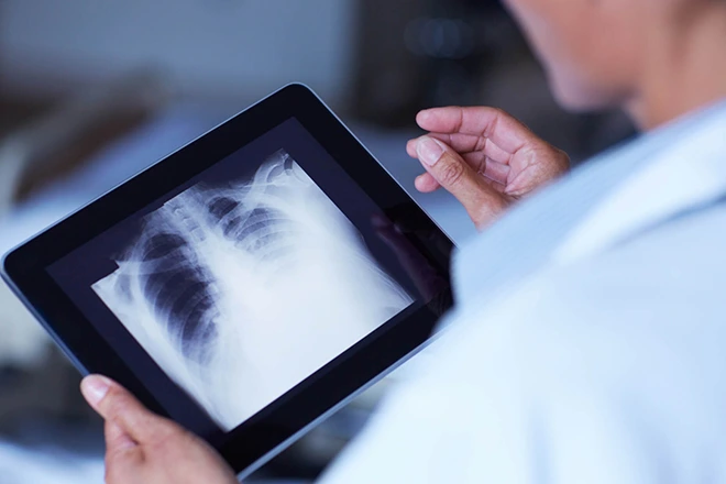 Doctor reviews chest X-ray on tablet, examining lungs.